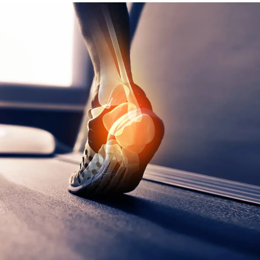 Fasciite plantaire à Moissy-Cramayel