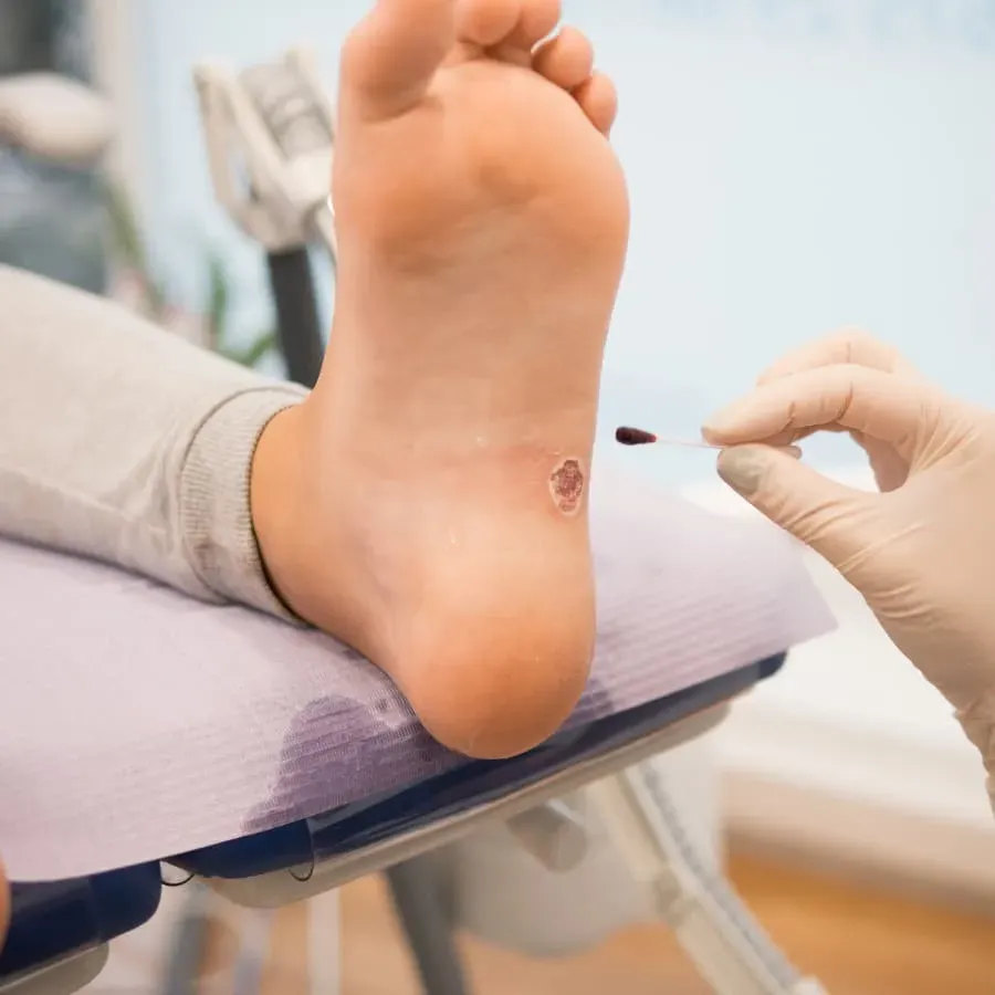 Épine calcanéenne à Moissy-Cramayel